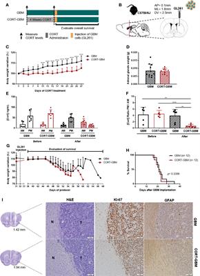 Chronic Stress Does Not Influence the Survival of Mouse Models of Glioblastoma